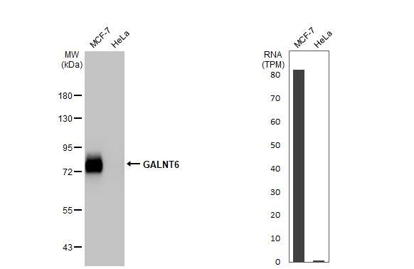 GALNT6 Antibody (HL2392) - Azide and BSA Free