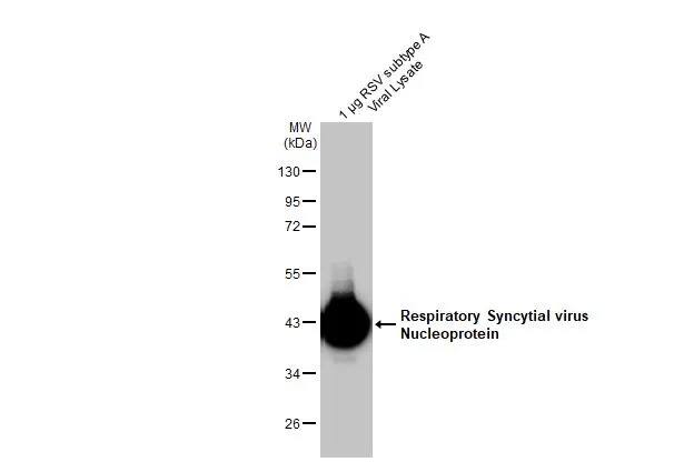 Respiratory Syncytial Virus Nucleoprotein Antibody (HL1296) - Azide and BSA Free