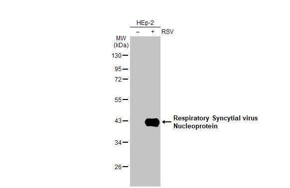 Respiratory Syncytial Virus Nucleoprotein Antibody (HL1296) - Azide and BSA Free