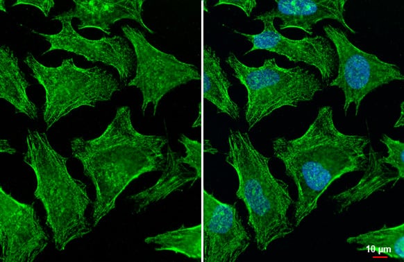 Gelsolin/GSN Antibody (HL1930) - Azide and BSA Free