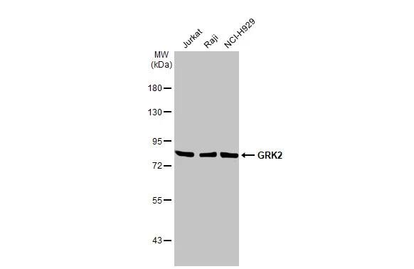 GRK2 Antibody (HL1562) - Azide and BSA Free