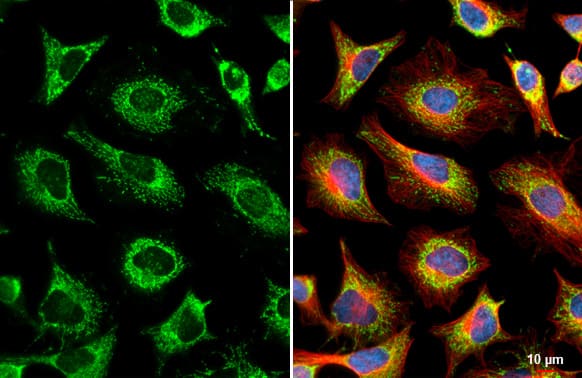 GRK2 Antibody (HL1562) - Azide and BSA Free