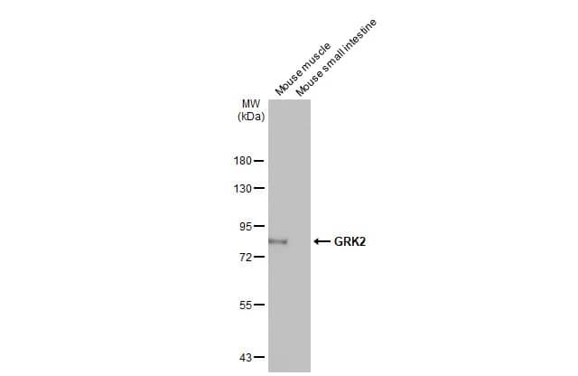 GRK2 Antibody (HL1562) - Azide and BSA Free
