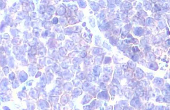 GRK2 Antibody (HL1562) - Azide and BSA Free