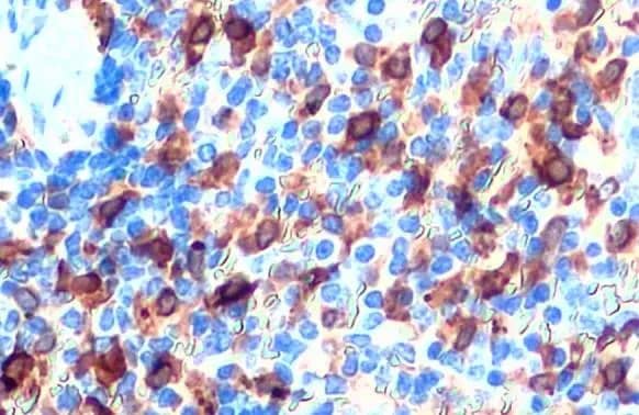 HO-1/HMOX1/HSP32 Antibody (HL1780) - Azide and BSA Free