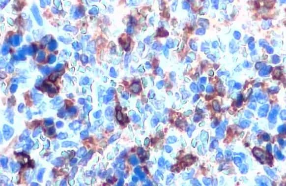 HO-1/HMOX1/HSP32 Antibody (HL1780) - Azide and BSA Free