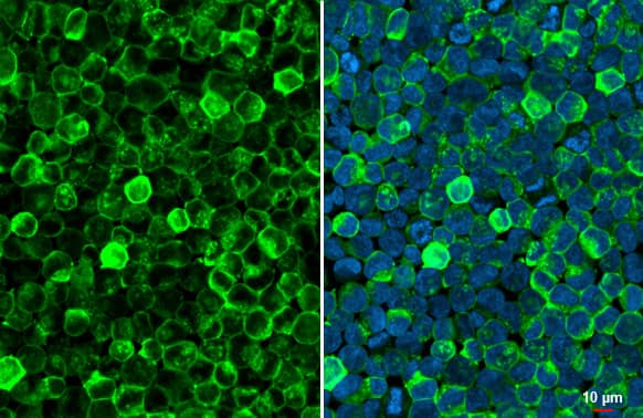 Hemoglobin epsilon Antibody (HL2457) - Azide and BSA Free