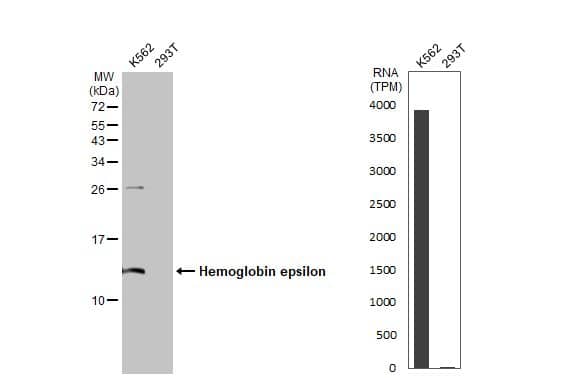 Hemoglobin epsilon Antibody (HL2458) - Azide and BSA Free