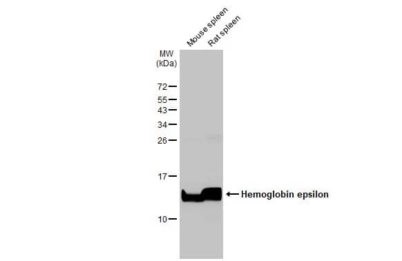 Hemoglobin epsilon Antibody (HL2458) - Azide and BSA Free
