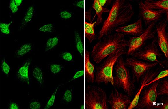 HES-1 Antibody (HL2198) - Azide and BSA Free