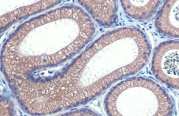 Hip Antibody (HL1737) - Azide and BSA Free