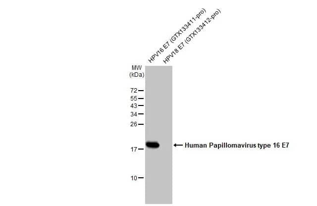 HPV16 E7 Antibody (HL1821) - Azide and BSA Free