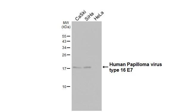 HPV16 E7 Antibody (HL1821) - Azide and BSA Free