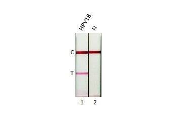 HPV18 E7 Antibody (HL2522) - Azide and BSA Free