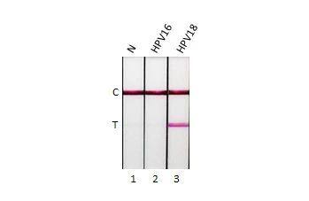 HPV18 E7 Antibody (HL2522) - Azide and BSA Free