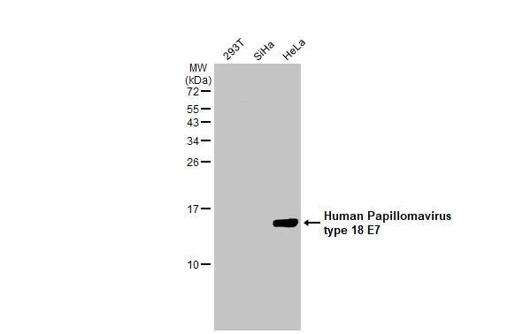 HPV18 E7 Antibody (HL2522) - Azide and BSA Free