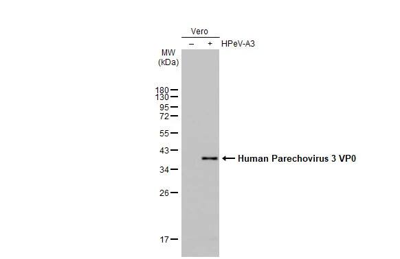 Human Parechovirus 1/3 VP0 Antibody (HL2443) - Azide and BSA Free
