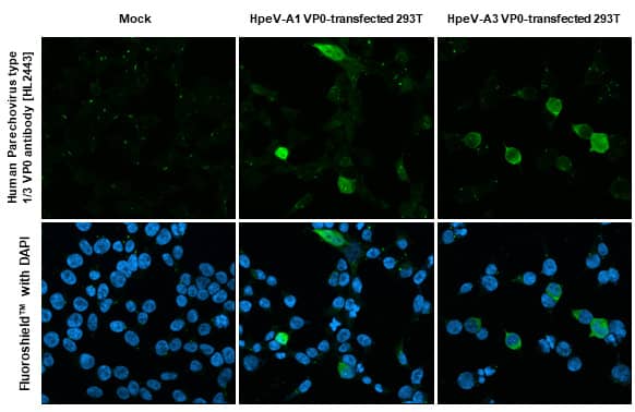 Human Parechovirus 1/3 VP0 Antibody (HL2443) - Azide and BSA Free
