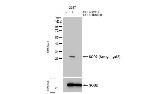 SOD2/Mn-SOD [ac Lys68] Antibody (HL1460) - Azide and BSA Free