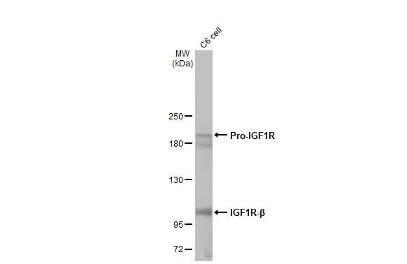 IGF-I R/IGF1R Antibody (HL1957) - Azide and BSA Free