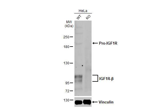 IGF-I R/IGF1R Antibody (HL1957) - Azide and BSA Free