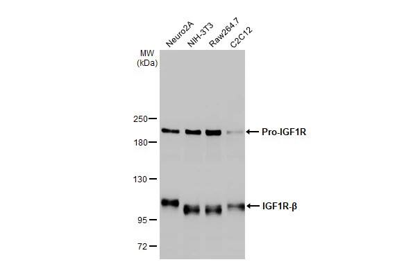 IGF-I R/IGF1R Antibody (HL1957) - Azide and BSA Free