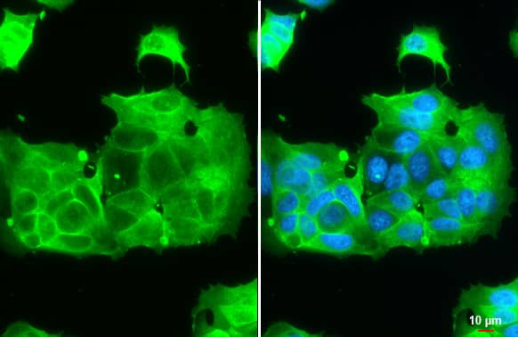 IGF-I R/IGF1R Antibody (HL1957) - Azide and BSA Free