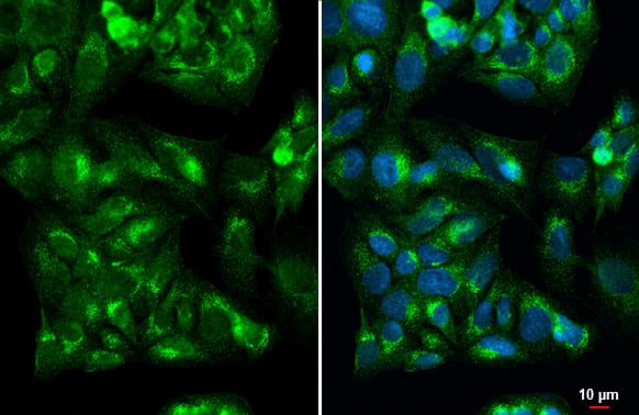 IGF-II/IGF2 Antibody (HL1982) - Azide and BSA Free