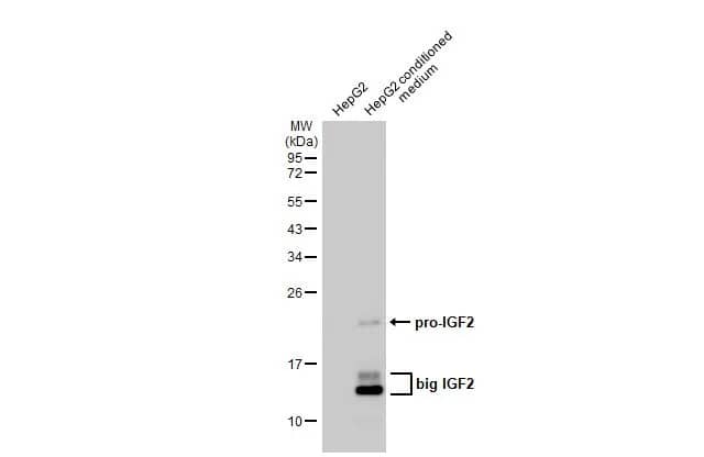 IGF-II/IGF2 Antibody (HL1982) - Azide and BSA Free