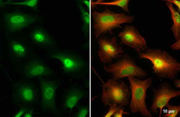 IKK gamma Antibody (HL1577) - Azide and BSA Free