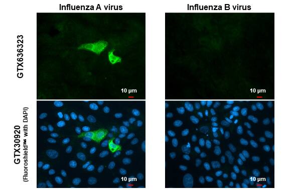 Influenza A H1N1 Neuraminidase Antibody (HL1108) - Azide and BSA Free
