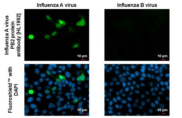 Influenza A H1N1 PB2 Antibody (HL1992) - Azide and BSA Free