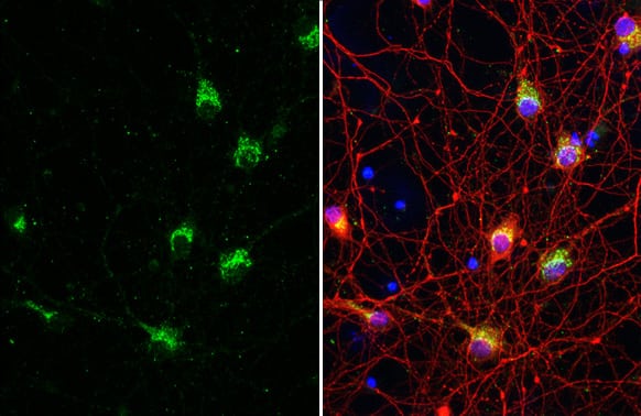 IP3R1 Antibody (HL1541) - Azide and BSA Free