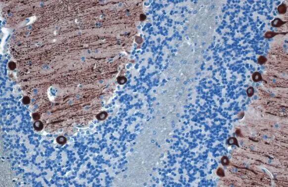 IP3R1 Antibody (HL1541) - Azide and BSA Free