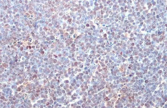 ITK Antibody (HL1264) - Azide and BSA Free