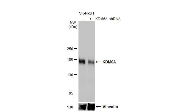 KDM6A Antibody (HL1731) - Azide and BSA Free