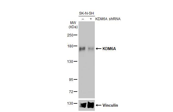 KDM6A Antibody (HL2068) - Azide and BSA Free