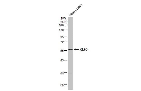 KLF5 Antibody (HL2269) - Azide and BSA Free