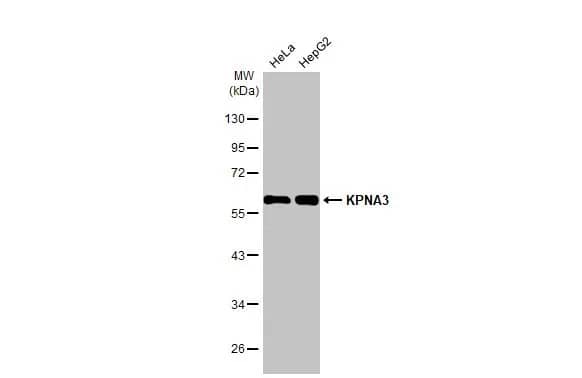 KPNA3 Antibody (HL1573) - Azide and BSA Free