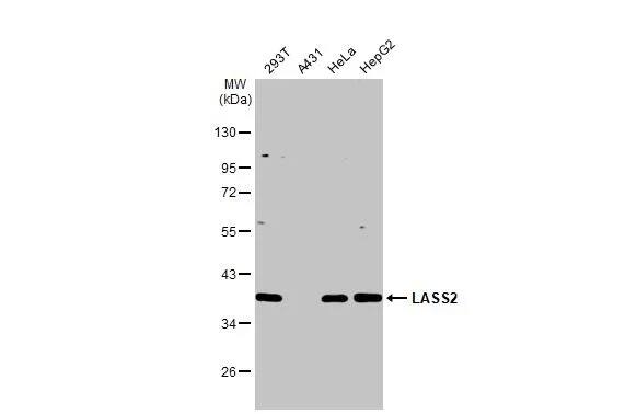 LASS2 Antibody (HL1717) - Azide and BSA Free