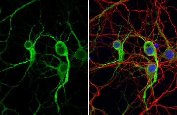 MAP2 Antibody (HL1656) - Azide and BSA Free
