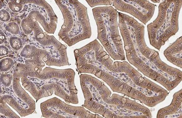 MAP3K8/Tpl2/COT Antibody (HL2118) - Azide and BSA Free