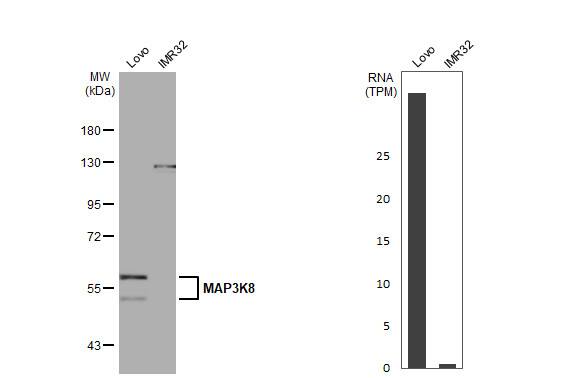 MAP3K8/Tpl2/COT Antibody (HL2118) - Azide and BSA Free