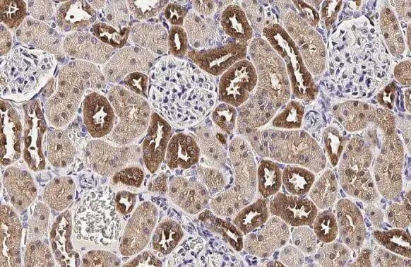 Melanocortin-1 R/MC1R Antibody (HL1471) - Azide and BSA Free