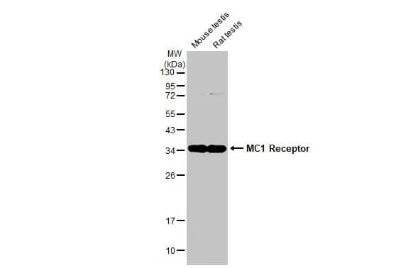 Melanocortin-1 R/MC1R Antibody (HL1471) - Azide and BSA Free