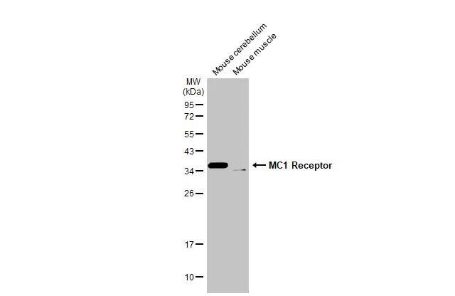 Melanocortin-1 R/MC1R Antibody (HL1471) - Azide and BSA Free