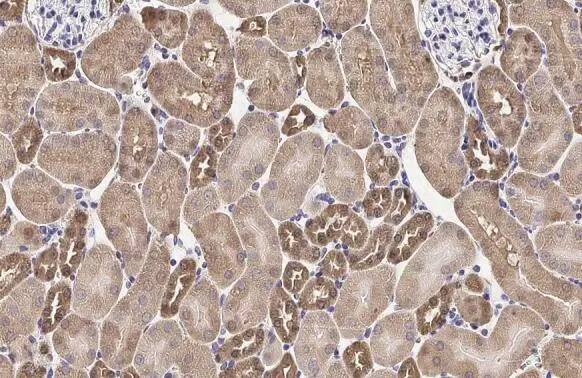 Melanocortin-1 R/MC1R Antibody (HL1471) - Azide and BSA Free