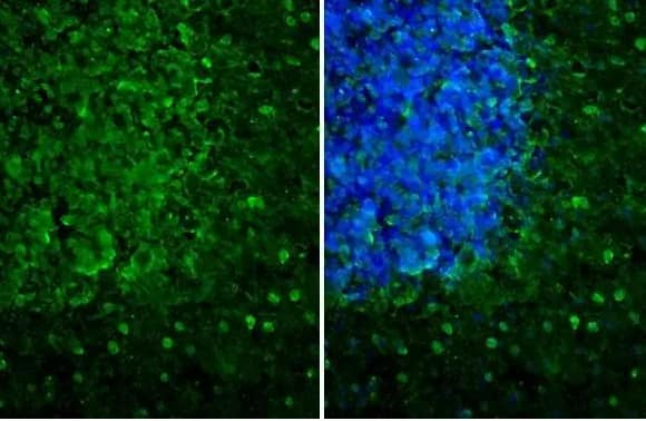 Melanocortin-1 R/MC1R Antibody (HL1471) - Azide and BSA Free