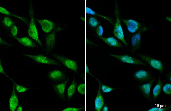 METTL1 Antibody (HL2041) - Azide and BSA Free