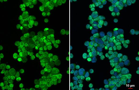METTL14 Antibody (HL1816) - Azide and BSA Free